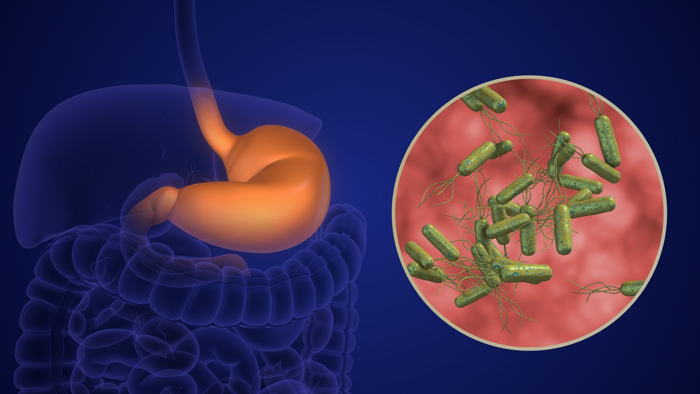 Skrandis ir Helicobacter Pylori