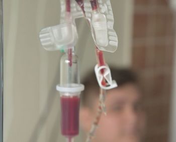 Naujas išsėtinės sklerozės gydymo būdas – kamieninių kraujodaros ląstelių transplantacija