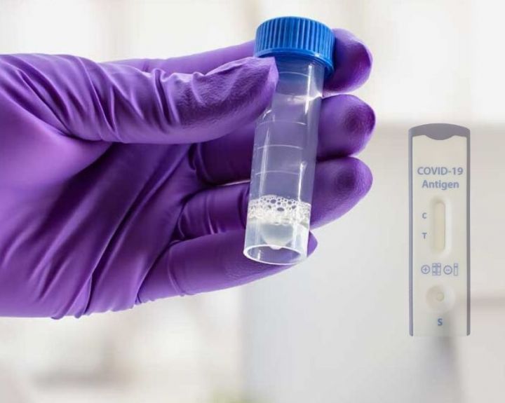 Pradedami naudoti Europos Komisijos dovanoti greitieji antigeno testai