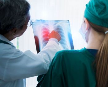 Plaučių vėžys: kodėl į užsitęsusį kosulį būtina atkreipti dėmesį?